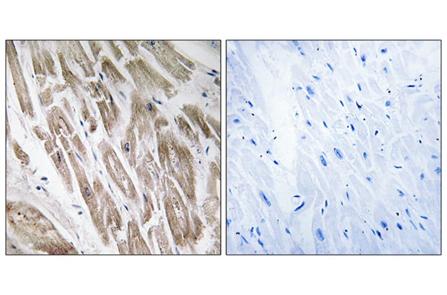 Immunohistochemistry - Anti-NDUFS5 Antibody (C16847) - Antibodies.com