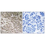 Immunohistochemistry - Anti-NDUFB1 Antibody (C16828) - Antibodies.com