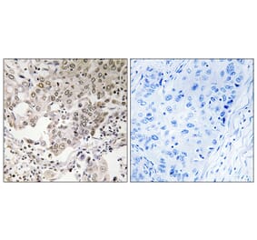 Immunohistochemistry - Anti-NCAPG2 Antibody (C15236) - Antibodies.com