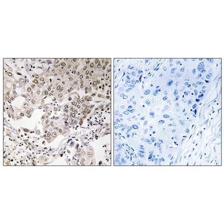 Immunohistochemistry - Anti-NCAPG2 Antibody (C15236) - Antibodies.com