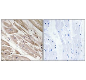 Immunohistochemistry - Anti-MYBPC3 Antibody (C16776) - Antibodies.com