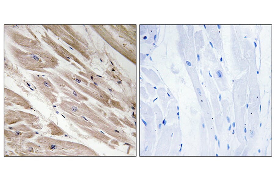 Immunohistochemistry - Anti-MYBPC3 Antibody (C16776) - Antibodies.com