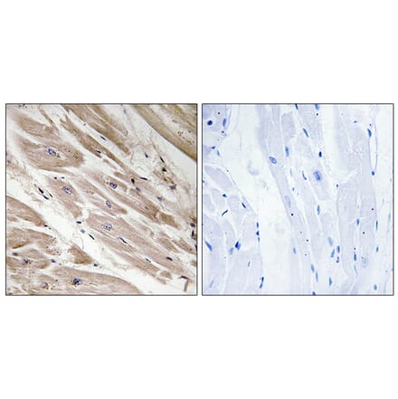 Immunohistochemistry - Anti-MYBPC3 Antibody (C16776) - Antibodies.com