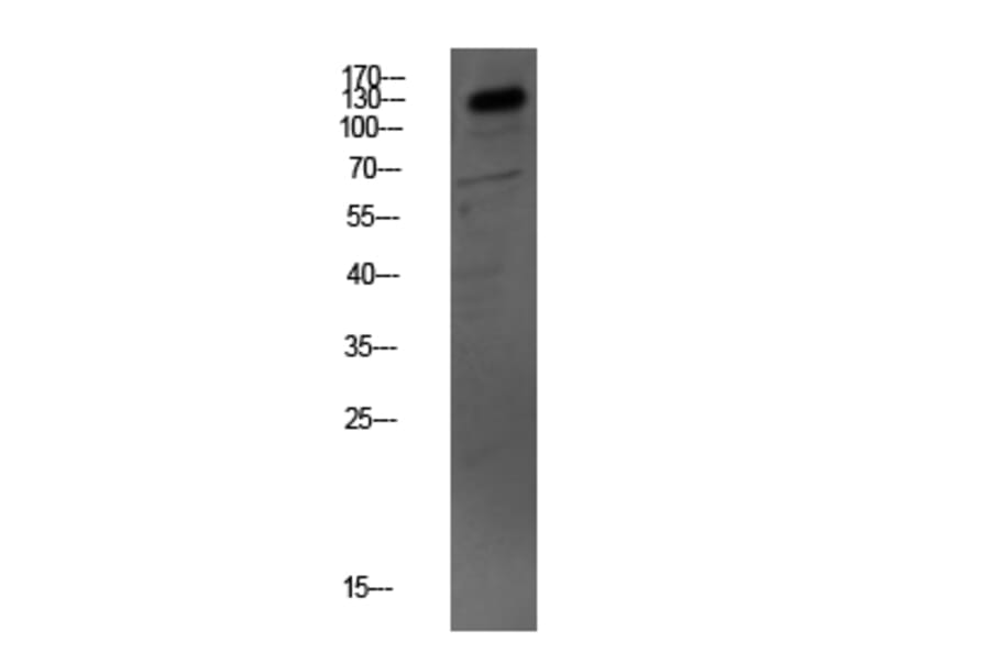Western Blot - Anti-MYBPC3 Antibody (C16776) - Antibodies.com