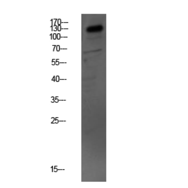 Western Blot - Anti-MYBPC3 Antibody (C16776) - Antibodies.com