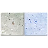 Immunohistochemistry - Anti-KIF13B Antibody (C16437) - Antibodies.com