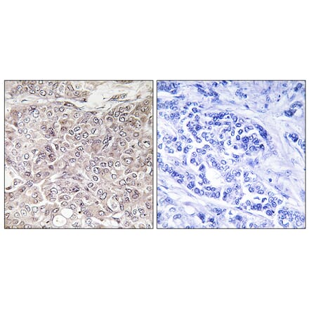 Immunohistochemistry - Anti-GPRIN3 Antibody (C15837) - Antibodies.com