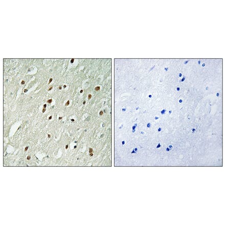 Immunohistochemistry - Anti-CNTROB Antibody (C15034) - Antibodies.com