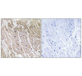 Immunohistochemistry - Anti-ACAD10 Antibody (C14253) - Antibodies.com