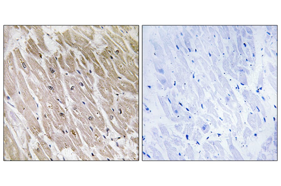 Immunohistochemistry - Anti-ACAD10 Antibody (C14253) - Antibodies.com