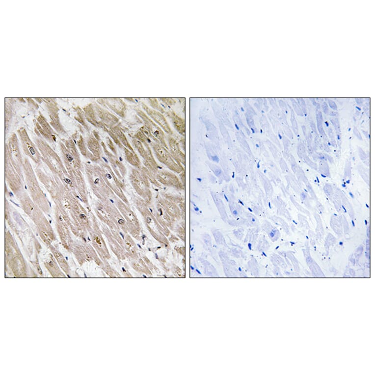 Immunohistochemistry - Anti-ACAD10 Antibody (C14253) - Antibodies.com