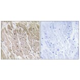 Immunohistochemistry - Anti-ACAD10 Antibody (C14253) - Antibodies.com