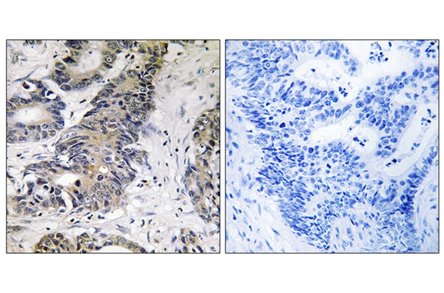 Immunohistochemistry - Anti-4E-BP1 Antibody (B8283) - Antibodies.com