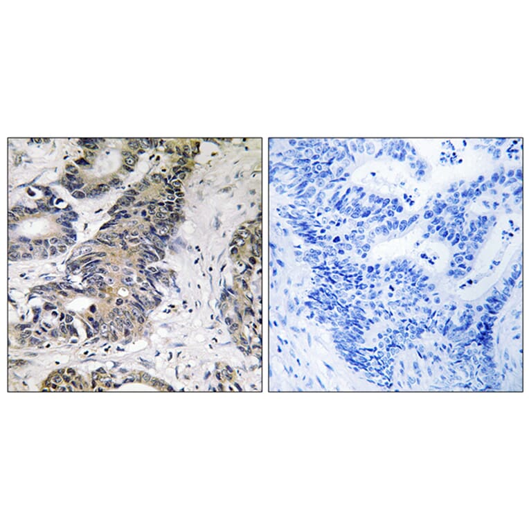 Immunohistochemistry - Anti-4E-BP1 Antibody (B8283) - Antibodies.com