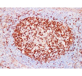 Immunohistochemistry - Anti-PD 1 Antibody (V0109) - Antibodies.com