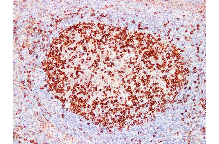 Immunohistochemistry - Anti-PD 1 Antibody (V0109) - Antibodies.com