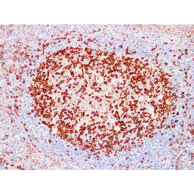 Immunohistochemistry - Anti-PD 1 Antibody (V0109) - Antibodies.com