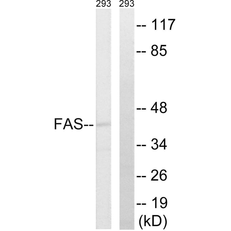Western Blot - Anti-FAS Antibody (B0927) - Antibodies.com