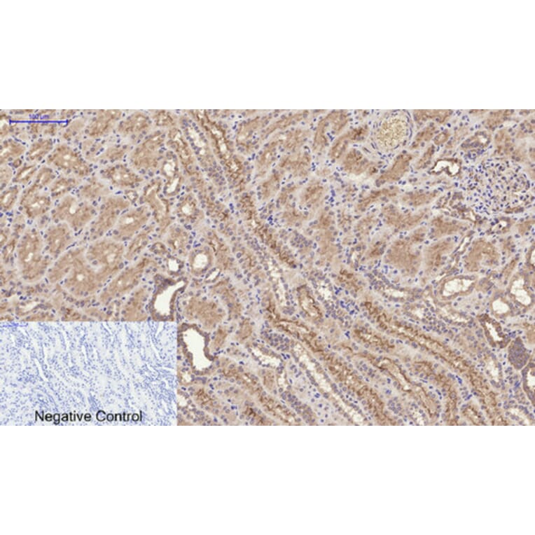 Immunohistochemistry - Anti-FAS Antibody (B0927) - Antibodies.com