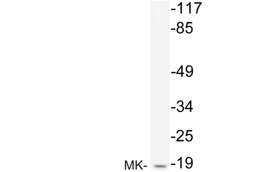 Western Blot - Anti-MK Antibody (R12-2240) - Antibodies.com