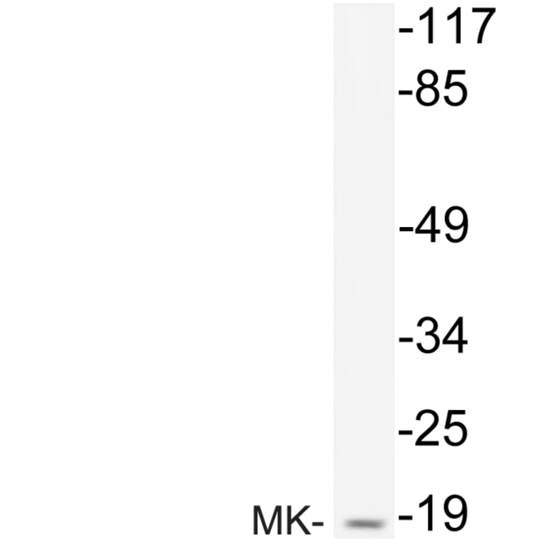 Western Blot - Anti-MK Antibody (R12-2240) - Antibodies.com