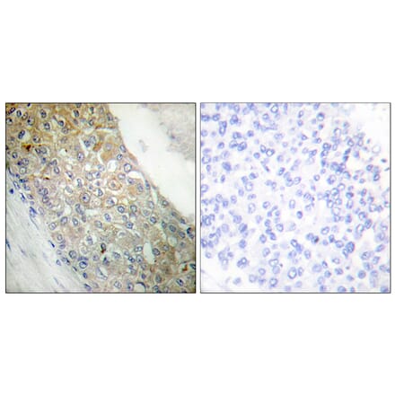 Immunohistochemistry - Anti-IR Antibody (B0493) - Antibodies.com