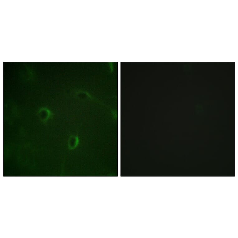 Immunofluorescence - Anti-IR Antibody (B0493) - Antibodies.com
