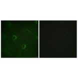 Immunofluorescence - Anti-IR Antibody (B0493) - Antibodies.com