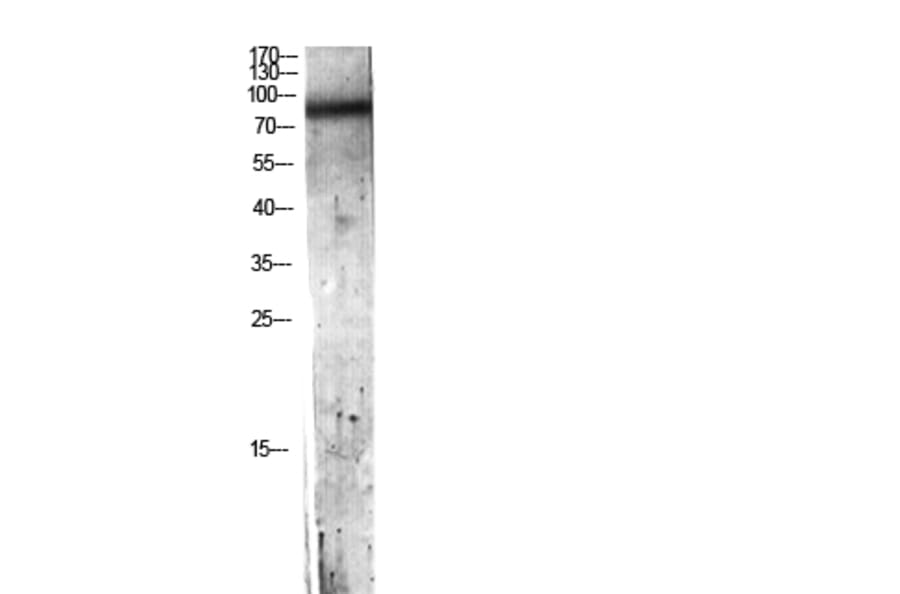 Western Blot - Anti-C7 Antibody (C30164) - Antibodies.com