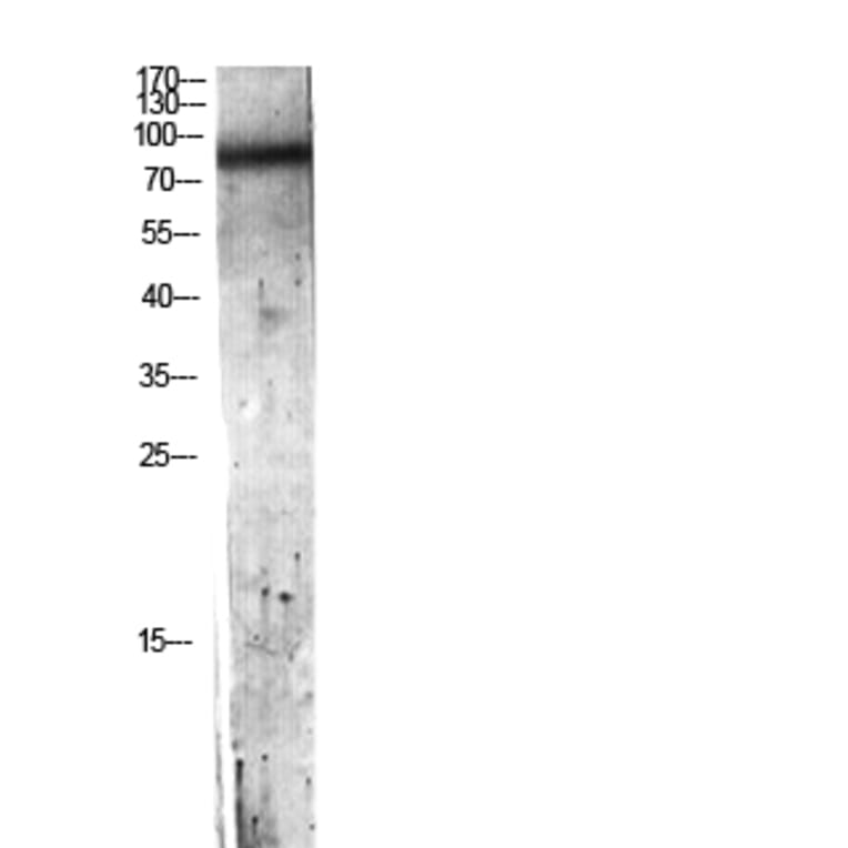 Western Blot - Anti-C7 Antibody (C30164) - Antibodies.com