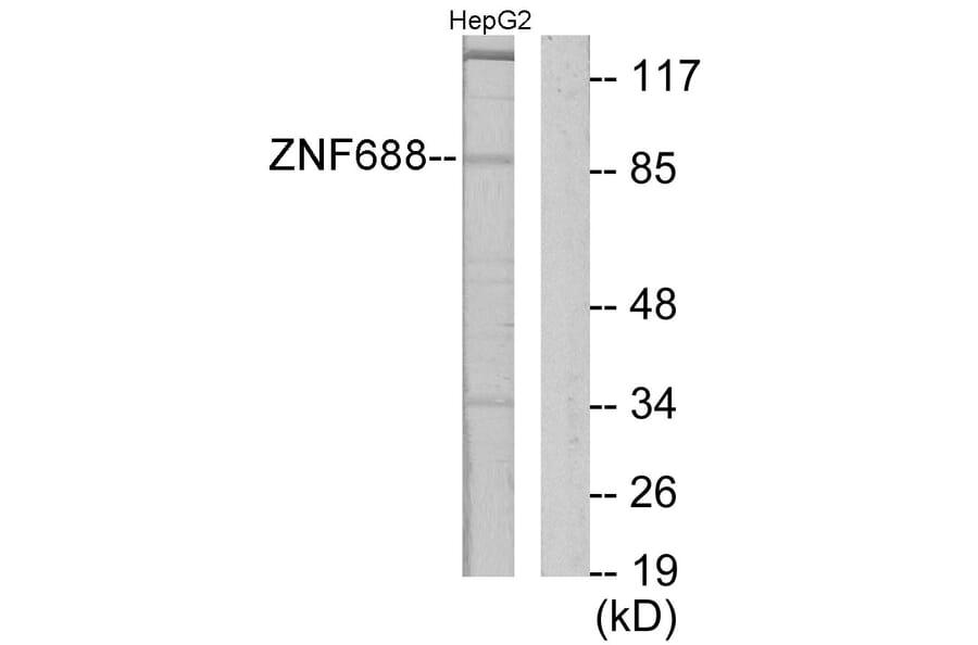 Western Blot - Anti-ZNF785 Antibody (C11407) - Antibodies.com