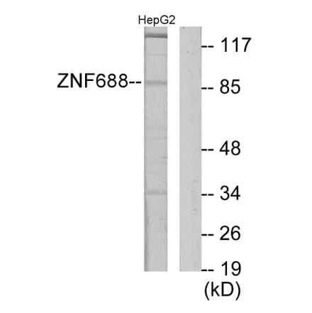 Western Blot - Anti-ZNF785 Antibody (C11407) - Antibodies.com