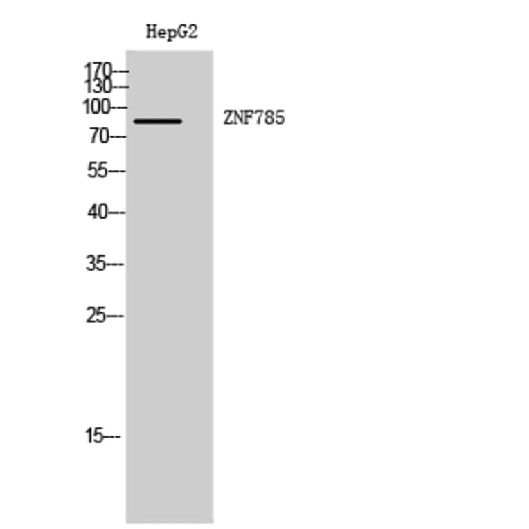 Western Blot - Anti-ZNF785 Antibody (C11407) - Antibodies.com