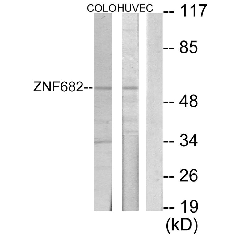Western Blot - Anti-ZNF682 Antibody (C10241) - Antibodies.com