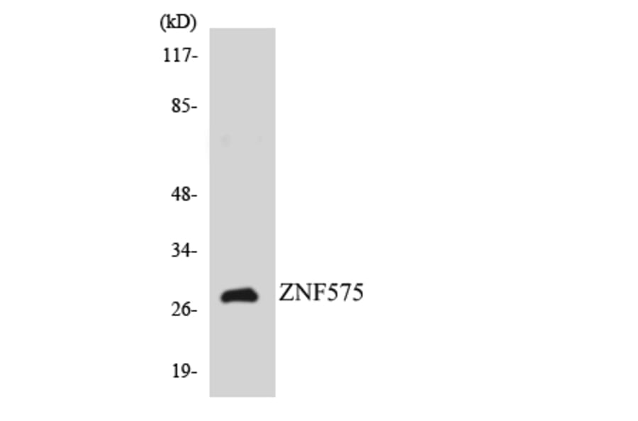 Western Blot - Anti-ZNF575 Antibody (R12-3703) - Antibodies.com