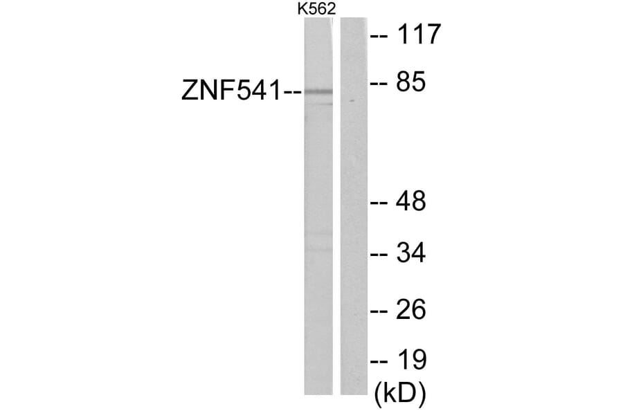 Western Blot - Anti-ZNF541 Antibody (C11671) - Antibodies.com