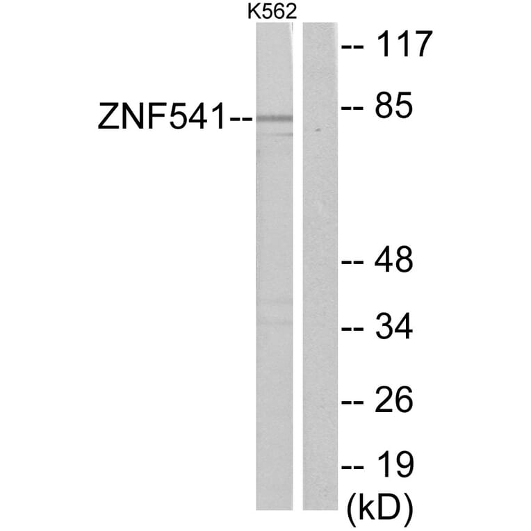 Western Blot - Anti-ZNF541 Antibody (C11671) - Antibodies.com