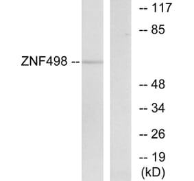 Western Blot - Anti-ZNF498 Antibody (C19675) - Antibodies.com