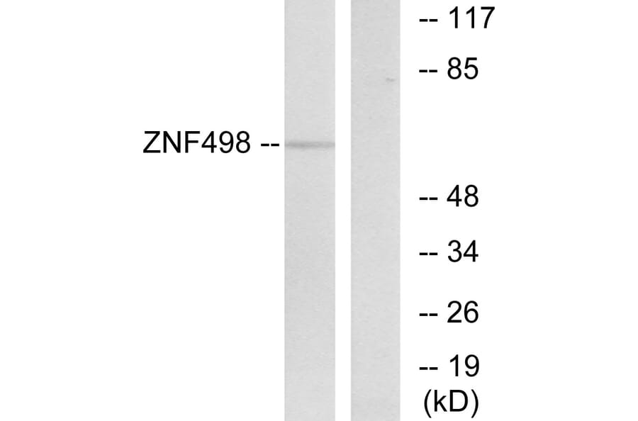 Western Blot - Anti-ZNF498 Antibody (C19675) - Antibodies.com