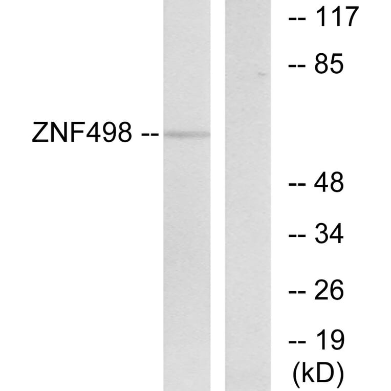 Western Blot - Anti-ZNF498 Antibody (C19675) - Antibodies.com