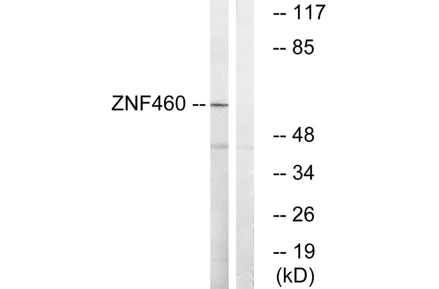 Western Blot - Anti-ZNF460 Antibody (C19600) - Antibodies.com