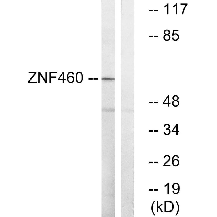 Western Blot - Anti-ZNF460 Antibody (C19600) - Antibodies.com