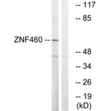 Western Blot - Anti-ZNF460 Antibody (C19600) - Antibodies.com