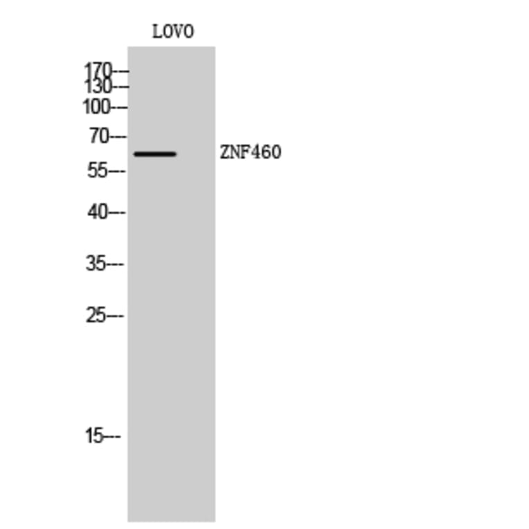 Western Blot - Anti-ZNF460 Antibody (C19600) - Antibodies.com
