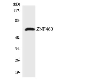 Western Blot - Anti-ZNF460 Antibody (R12-3701) - Antibodies.com