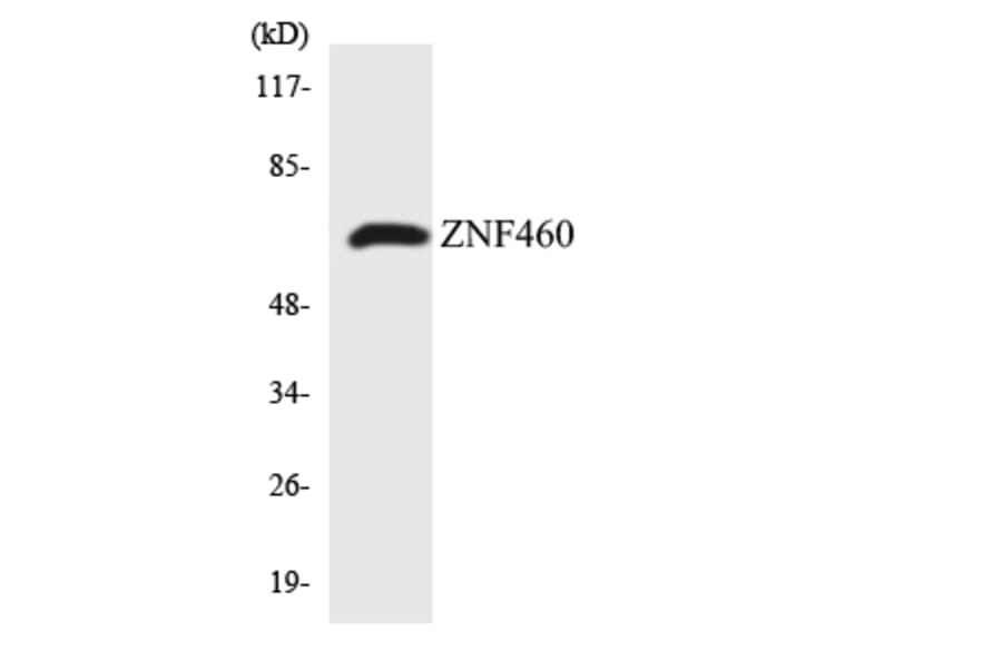 Western Blot - Anti-ZNF460 Antibody (R12-3701) - Antibodies.com