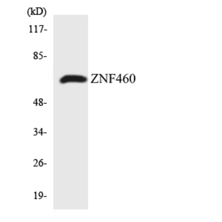 Western Blot - Anti-ZNF460 Antibody (R12-3701) - Antibodies.com