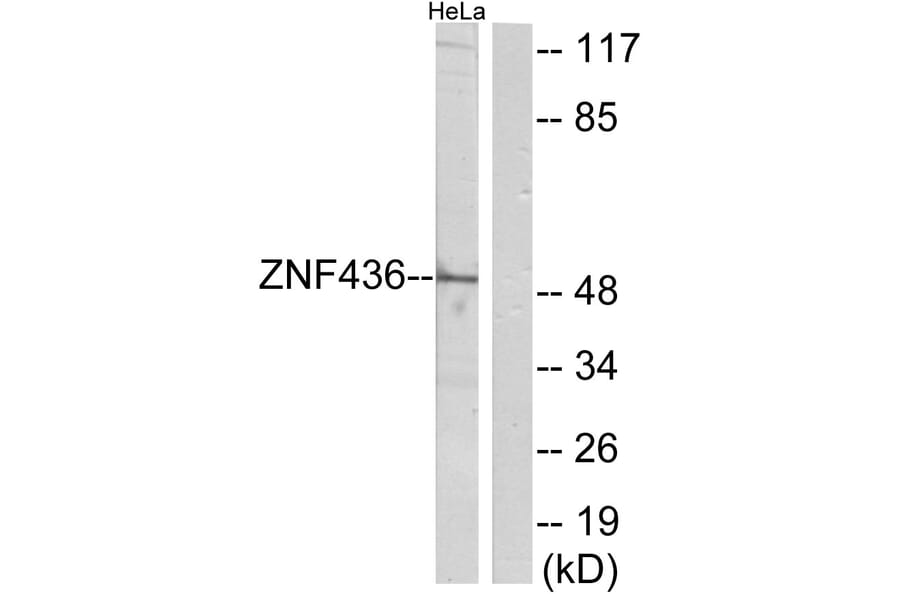 Western Blot - Anti-ZNF436 Antibody (C11660) - Antibodies.com
