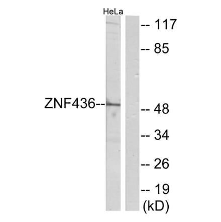 Western Blot - Anti-ZNF436 Antibody (C11660) - Antibodies.com