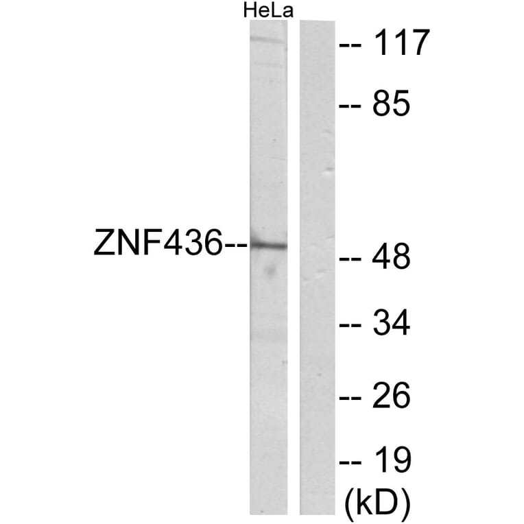 Western Blot - Anti-ZNF436 Antibody (C11660) - Antibodies.com